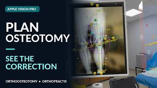 OrthoOsteotomy | X-Ray to Spatial Osteotomy Planning | Apple Vision Pro Tutorial screenshot 4