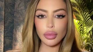 Larsa Pippen Responds to Viral “Overfilled Face” Claims, Says Swelling Was Due to Allergic Reaction