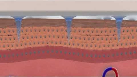 BEAUCROS MICRO NEEDLE PATCH