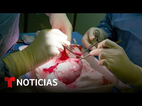 Experta explica trasplante de corazón de un cerdo a hombre | Noticias Telemundo