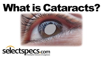 What Is Cataracts - With SelectSpecs.com