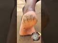 Mix shampoo with lemon | Get rid of Dry feet.#heelcare #footcleaning #softfeetcare #ytshorts