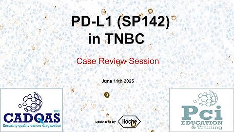 CADQAS Proficiency Test Case Review Session for PT 226 - PD L1 (SP142) in TNBC
