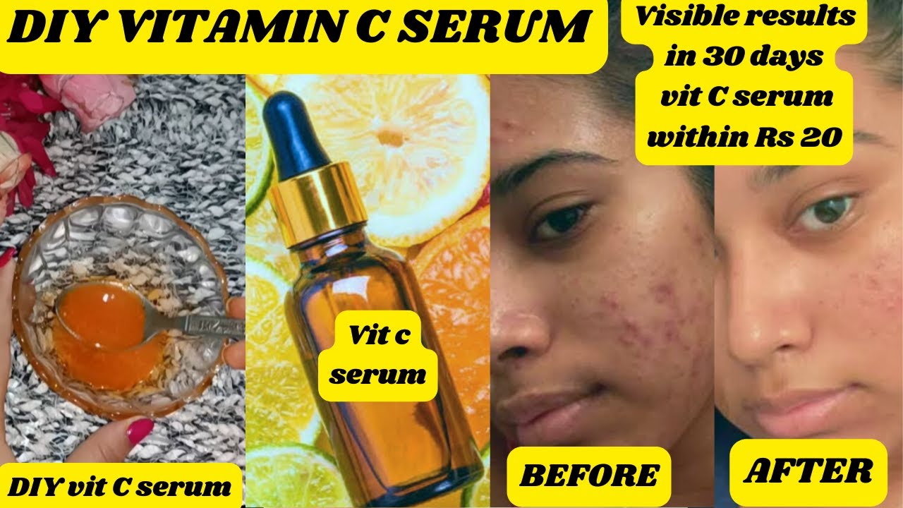 I used this VIT C serum for 3 days and it changed my skin See how to