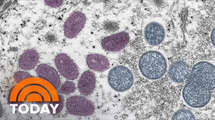 US Steps Up Efforts To Address Escalating Monkeypox Outbreak - DayDayNews