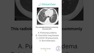 Ground-Glass Opacity on Chest CT High-Yield Radiology Case