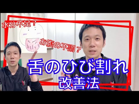 【舌の亀裂】舌にひび割れや亀裂がある人は要注意。原因と改善法を紹介します！