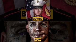 the US marine who became a robot|Kyle Carpenter |Plug Tv Kenya #shorts #plugtvkenya #usmarine