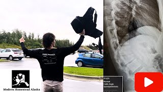 Best video ever made in Alaska Last Doctors appointment for broken teen boys back. broken healed