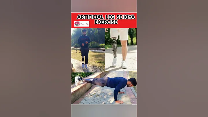 Artificial Leg Se Kiya Regular Exercise #ossur #shortvideo #prosthetic #ytshorts #motivation #foryou