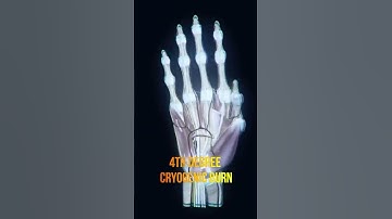 What If You Touched Absolute Zero? Coldest Temperature on Universe #shorts