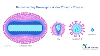 Monkeypox A Global Concern in the Spotlight I EVERBLINK