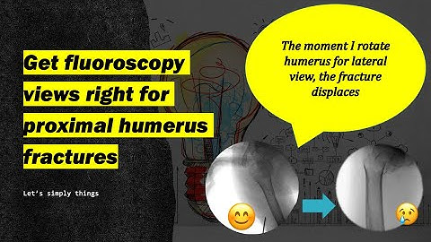 Fluoroscopy in proximal humerus fractures simplified