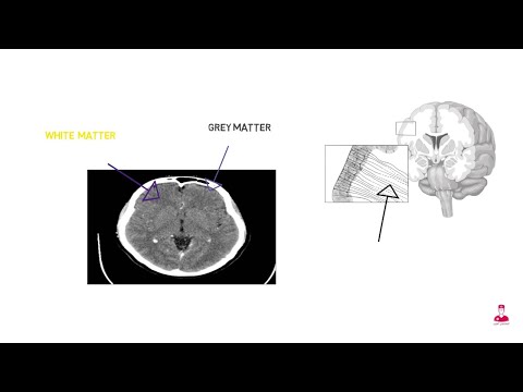 فيديو: أين تقع المادة الرمادية في المخ؟