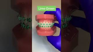 Best braces colors for tan skin. What other colors are your favorite? #drwindhorst Best braces colors for tan skin. What other colors are your favorite? #drwindhorst