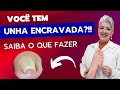 Você tem UNHA ENCRAVADA | Saiba o que fazer