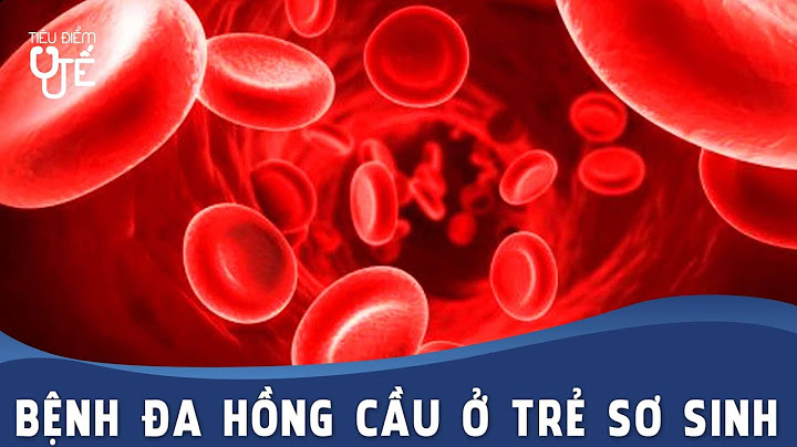 Cách chữa hồng cầu cao