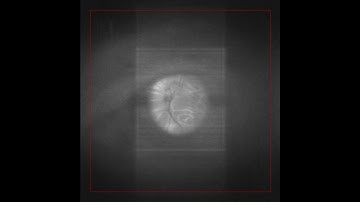 Real-time holographic imaging from the cornea to the retina
