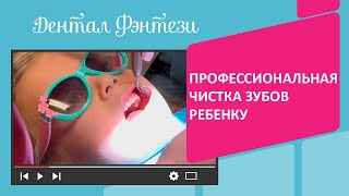 👍 🦷  Профессиональная чистка зубов ребенку