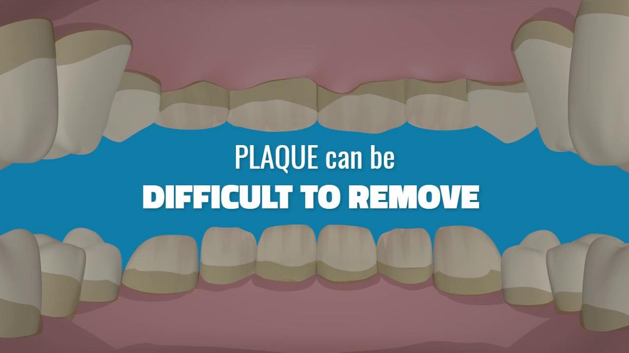 Hydro Floss® makes it Easy