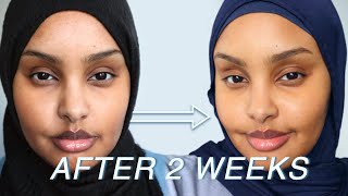 How I Repaired My Skin Barrier In 2 Weeks | Let&#39;s Talk Skin | Jasmine Egal