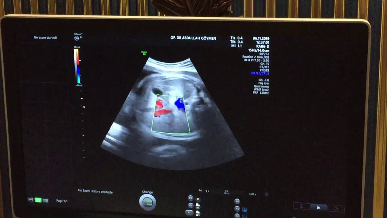 33. Hafta Gebelik YouTube