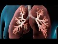 COPD I Nucleus Health