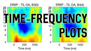Famous [EEGLAB] Create Time-Frequency Plots Using STUDY Profile