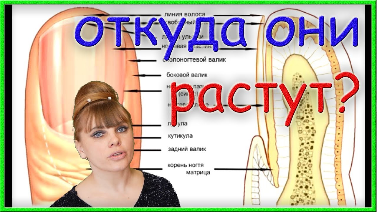 Как растут чери