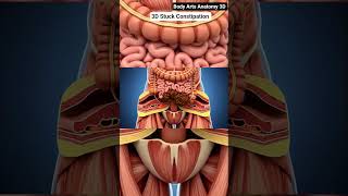 US Illustration Of Stuck Constipation Moving Gut Health Body Arts ...