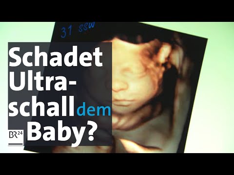 Video: Der Geist Der Großmutter Wurde Im Ultraschall Des Ungeborenen Kindes Gesehen - Alternative Ansicht