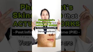 Not ALL acne marks are pigmentation!