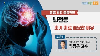 발병 원인 불명확한 ‘뇌전증’ 초기 치료 중요한 이유