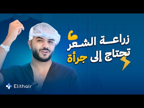 الرحال جهاد معنون يشارك تجربته الخاصة في زراعة الشعر في تركيا مع إليت هير