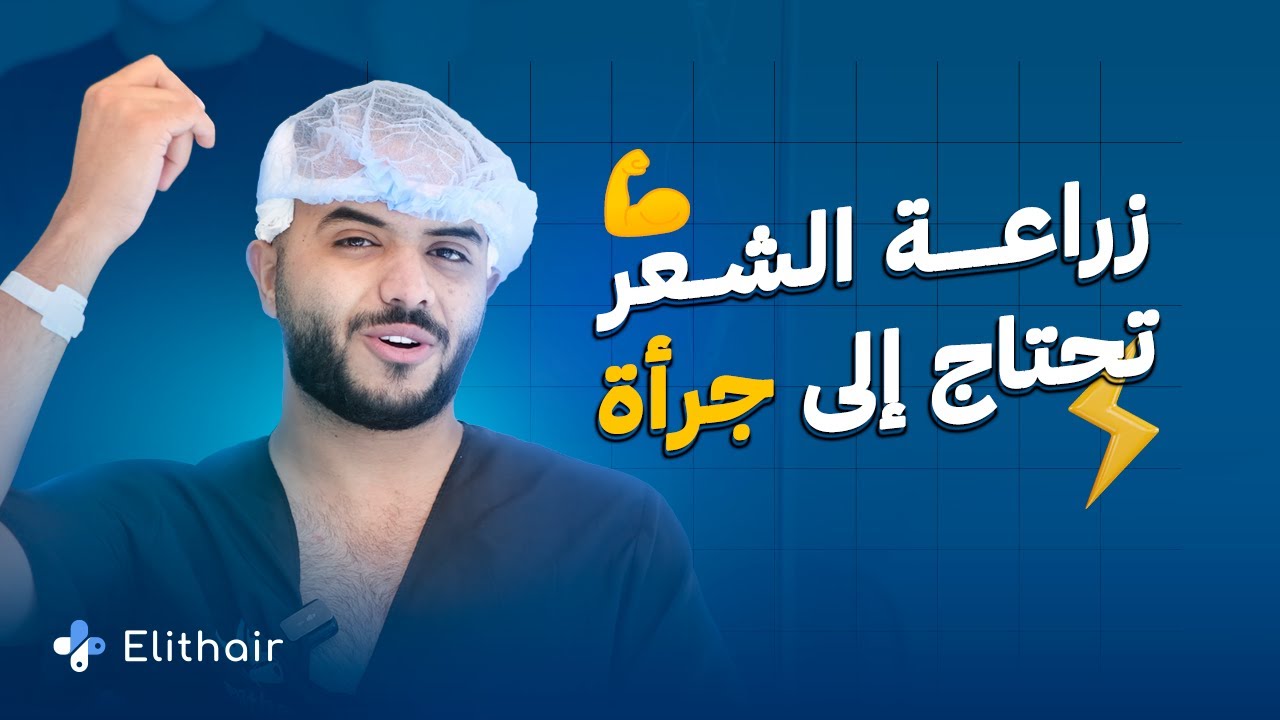 الرحال جهاد معنون  يشارك تجربته الخاصة في زراعة الشعر في تركيا مع إليت هير
