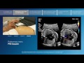 Advanced screening views of the fetal heart - Part 2 - Pulmonary veins color and PW Doppler