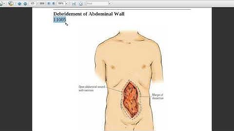 Integumentary system - Debridement - Current Procedural Terminology