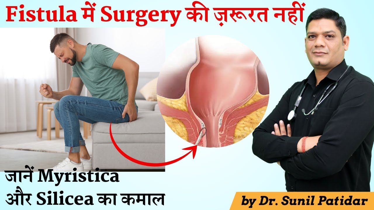 Surgery is not required in Fistula | Know Homeopathic Medicine Myristica and Silicea | Dr. Patidar