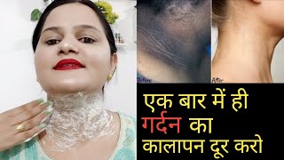काली गर्दन से छुटकारा मात्र 15 मिनट में(घरेलू उपाय) how to remove dark neck