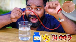 My Blood Vs Hydrogen Peroxide | രക്തം വെച്ചുള്ള കളി | M4 Tech |