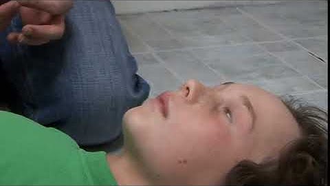 Epilepsy SA NT   How to administer Intranasal Midazolam