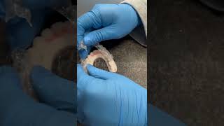 HOW TO WEAR A BROKEN RETAINER