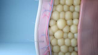 Cooltone By Allergan At Dermmedica In Kelowna