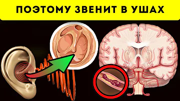 Шум в ушах пройдёт за 5 минут, если сделать 3 простых...