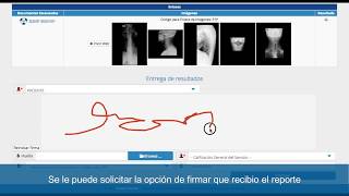 6. Entrega de resultados y consulta estudio - paciente