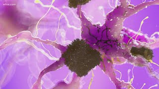 Famous Health Check: A groundbreaking study underway at UNT in Alzheimer's research Net Worth