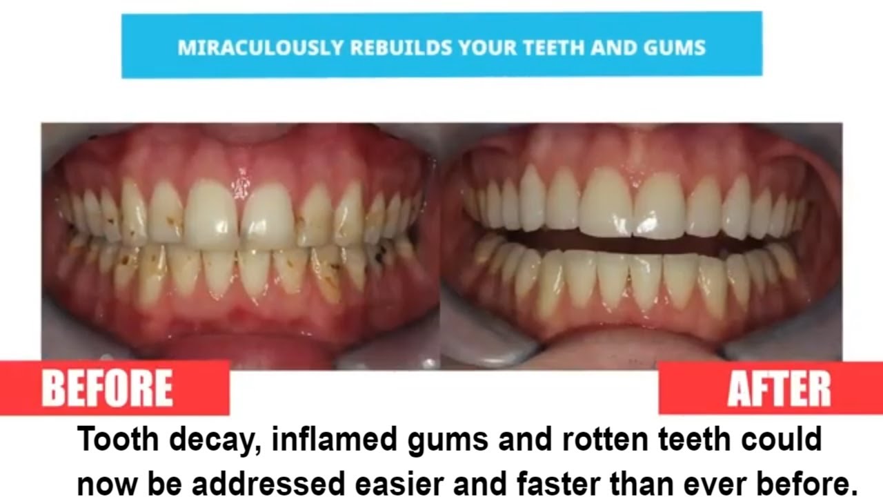 The ‘Mineral Candy’ That Supports Healthy Teeth And Gums -  Healthy Teeth