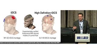 Dr. Marom Bikson: The potential and Limitations of Transcranial Direct Current Stimulation