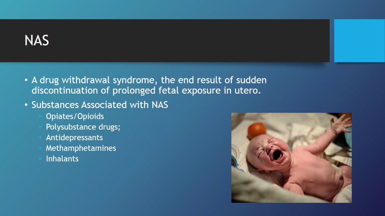 Neonatal Abstinence Syndrome YouTube