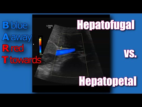 Hepatopetal vs  Hepatofugal?